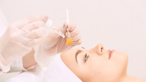 Chemical Peel