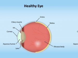 Diabetic retinopathy 