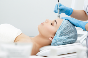 Microdermabrasion