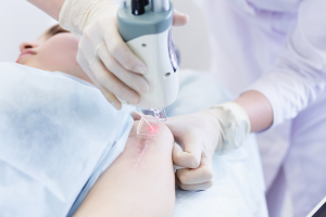 Scar Revision