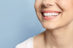 dental implant