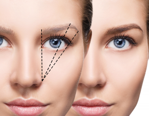 eyebrow transplant