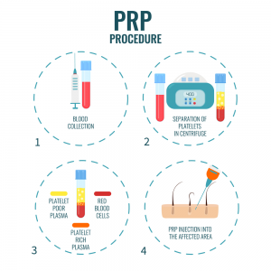 face prp