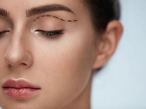 eylide surgery