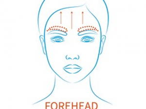 forehead contouring