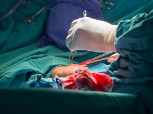 heart bypass