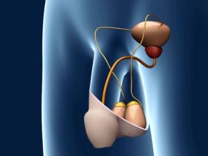 Testicular Implant