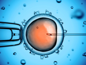 artificial insemination