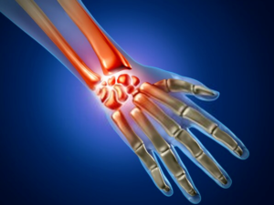 hand and wrist surgery