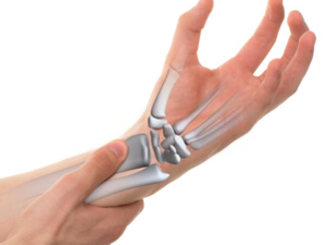 hand and wrist surgery