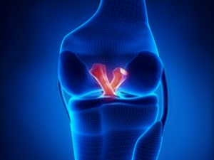 knee ligament surgery