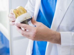 knee replacement
