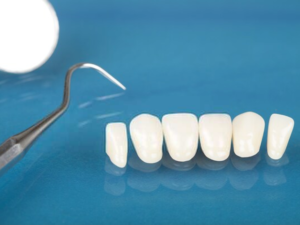 dental laminate