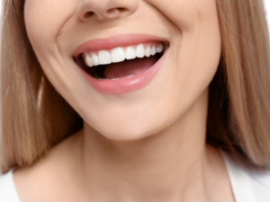 Hollywood smile