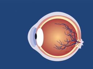  During Diabetic Retinopathy Treatment 