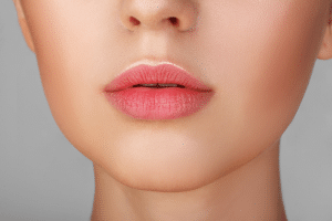 Lip Augmentation