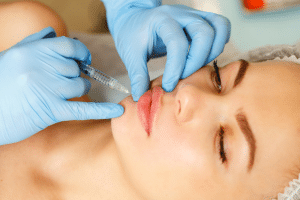  During Lip Augmentation 