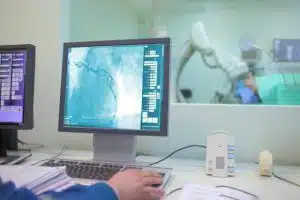 angiography 