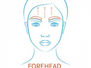 Forehead Contouring