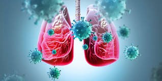 lung cancer in Iran