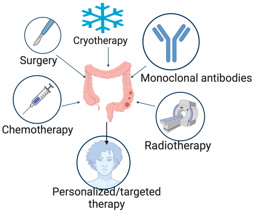 Colon Cancer Treatment Options