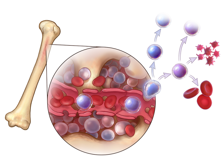 Bone Marrow Transplant